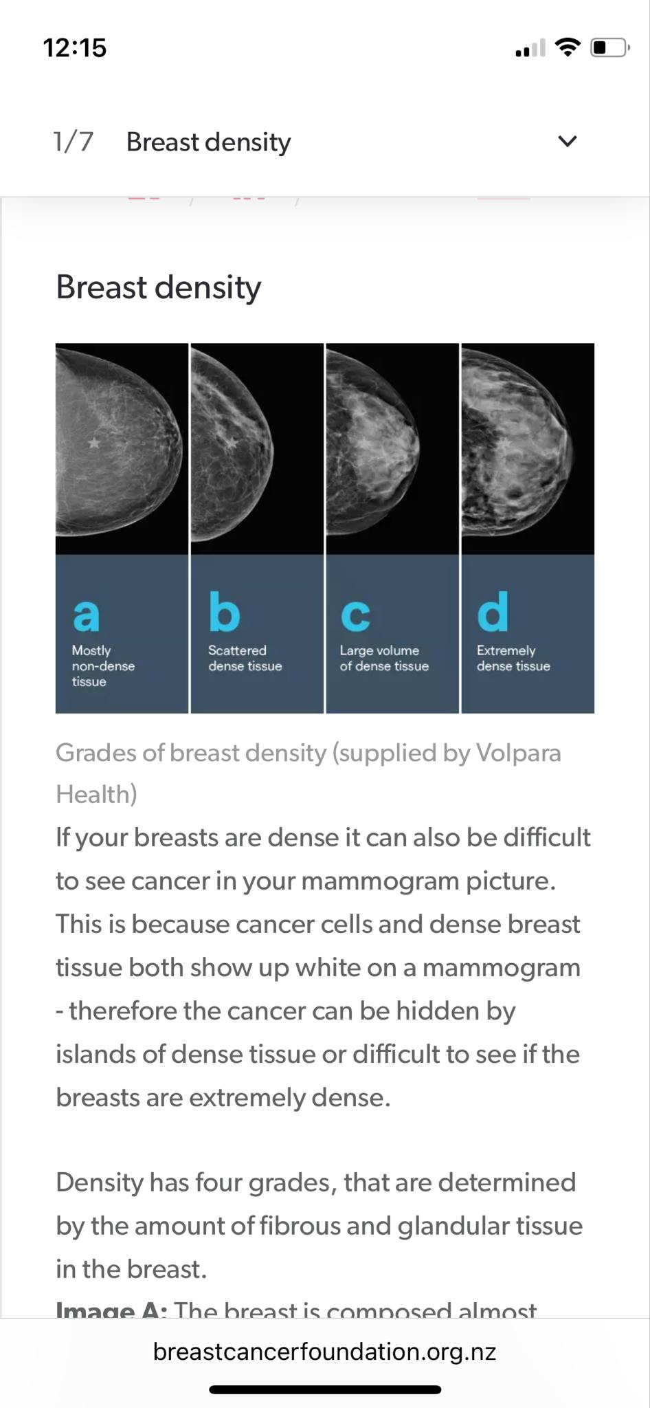 Julie's Story: Shining a light on Lobular Breast Cancer